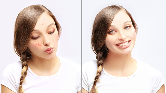 poros abiertos ya 2 Hábitos que obstruyen tus poros (y que ni imaginabas)