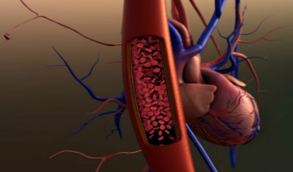 Cómo Hipertensión Arterial Sintomas el camino espartano