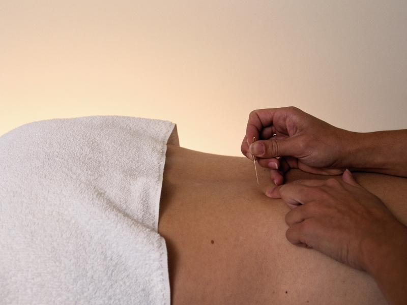La aplicación de la acupuntura debe ser aplicada por un experto en salud