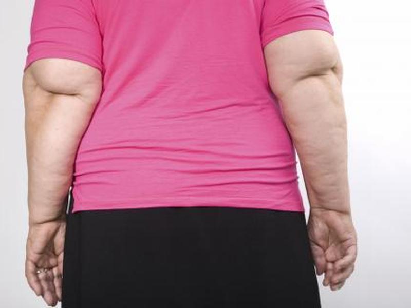 Grasa y sobrepeso no intervienen en problemas de lípidos