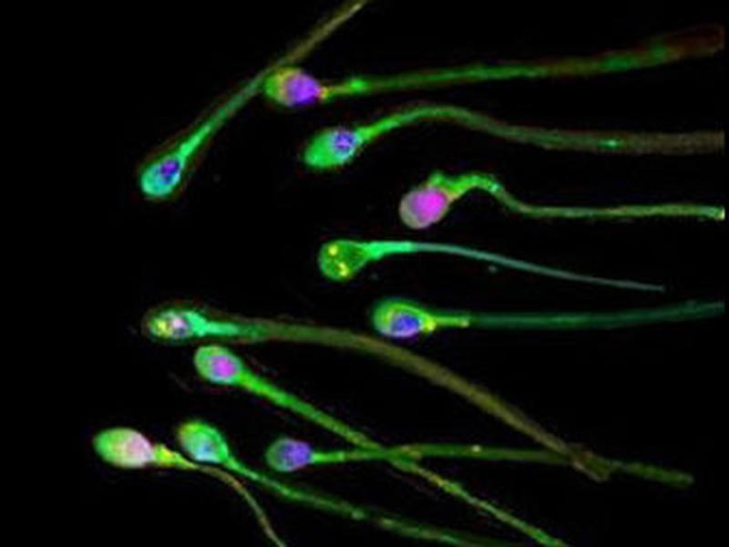 Las células de esperma producen insulina en ratones.