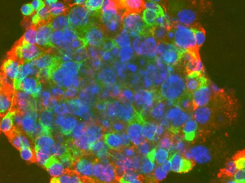 Células madre de origen adulto podrían presentar mutaciones que deriven en cáncer.