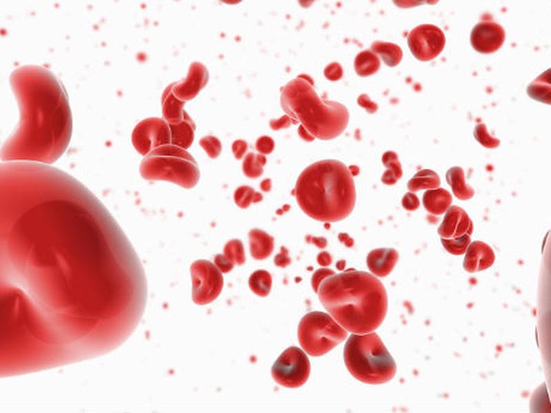 A nivel mundial, se estima que existan al menos 400 mil personas con hemofilia