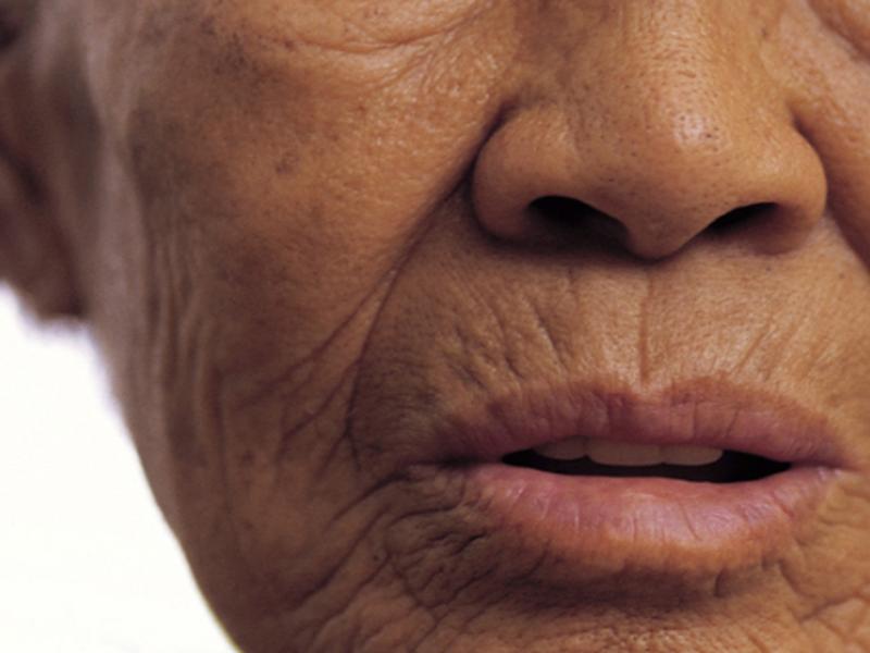 Envejecimiento de la piel por factores externos