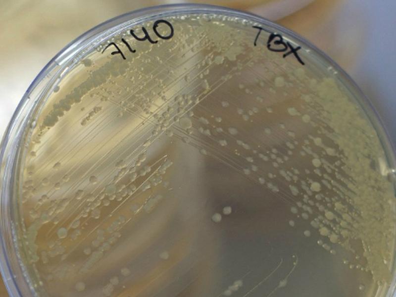E. coli se transmite de persona a persona