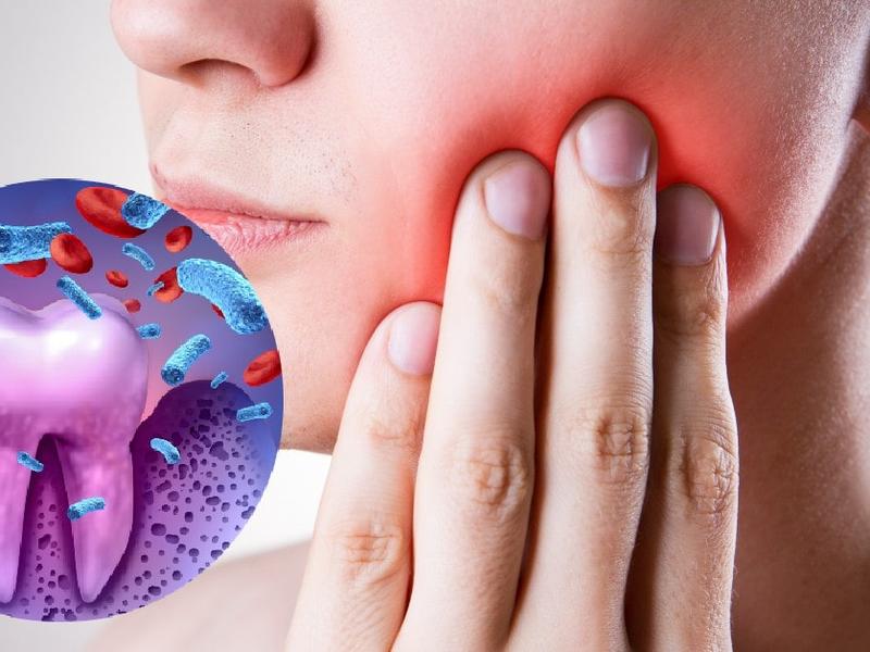 Persona con malestar en la boca ocasionado por periodontitits.