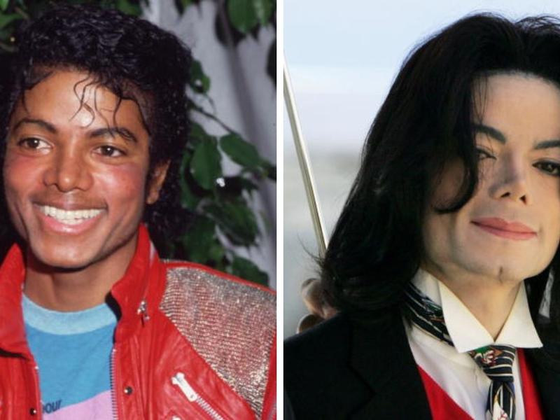 Una foto de Michael Jackson joven con la piel negra, y al lado una foto de él con la piel blanca. 