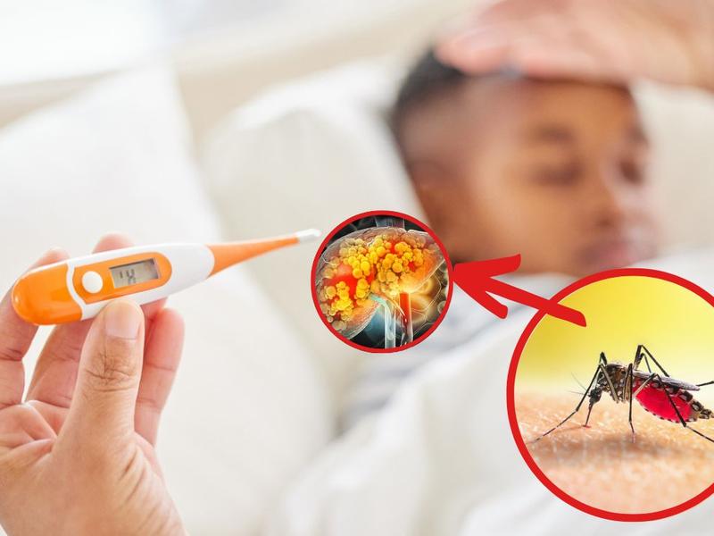Menor con fiebre, ilustración de hígado dañado, mosquito para explicar qué es la malaria y cómo se contagia