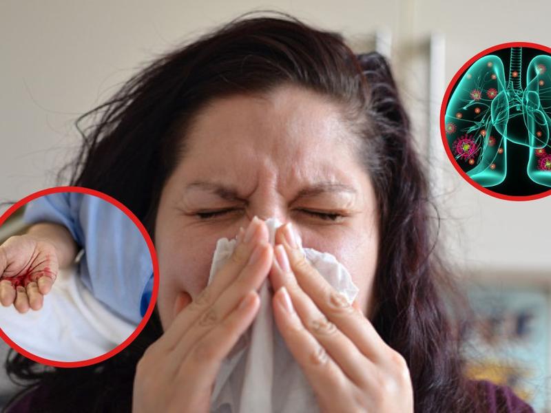 Mano con sangre falsa, mujer con pañuelo en la nariz, ilustración de pulmones para explicar qué es la poliangeitis microscópica