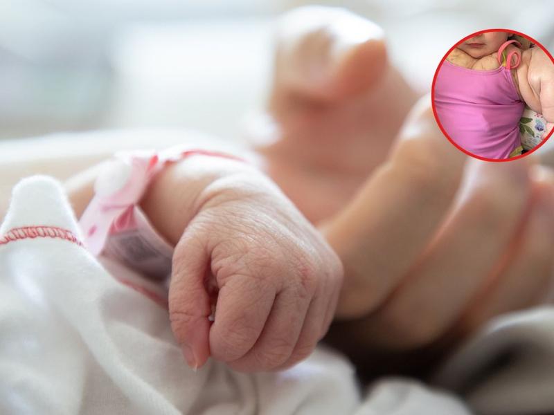 Mano de bebé sobre mano de adulto, cuerpo de Armani Milby para explicar qué es un linfangioma