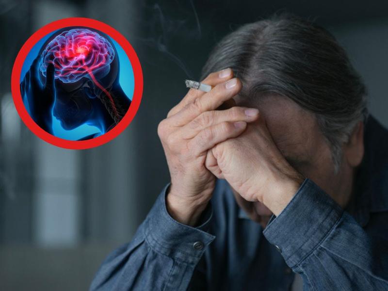 Hombre con cigarro, ilustración de cerebro afectado por el cigarro. 