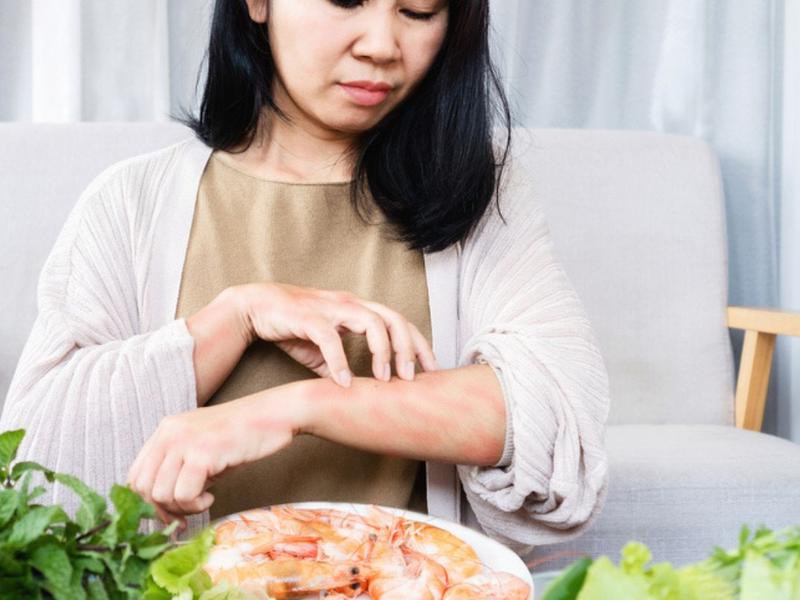 Mujer rascándose el brazo con plato de camarones en frente para explicar cuáles son las alergias más comunes