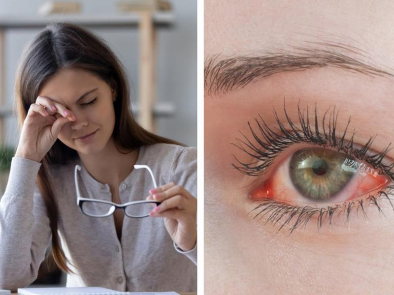 Mujer frotándose el ojo, mujer con ojo rojo muestra cómo aliviar el ojo seco