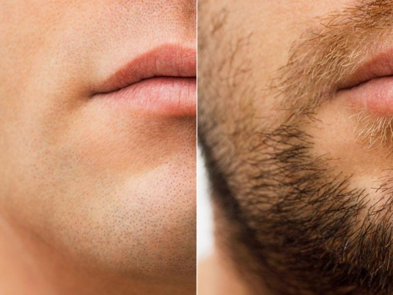Hombre con barba antes y después