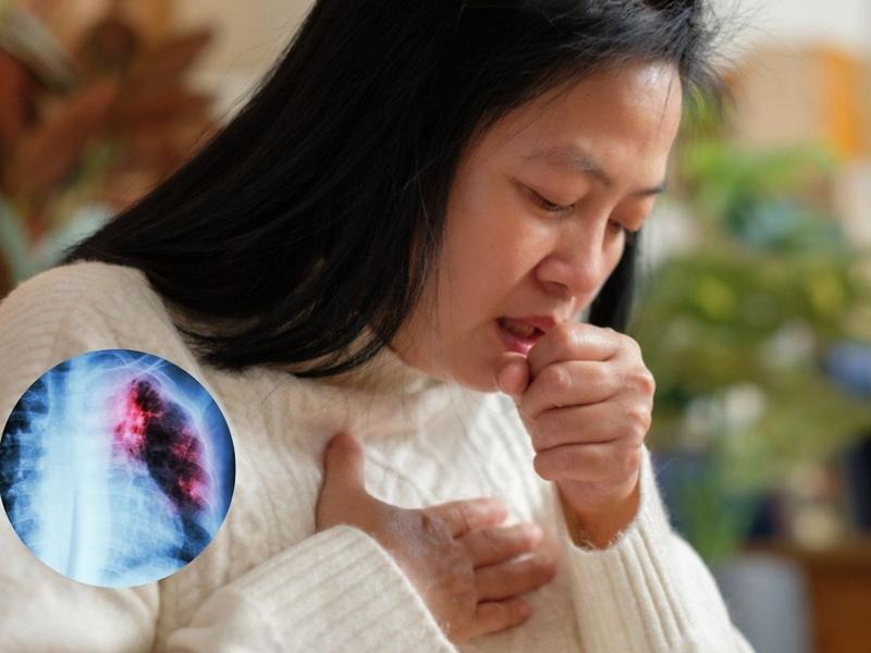 Mujer con tos, imagen de pulmón dañado para explicar las cosas que los dañan