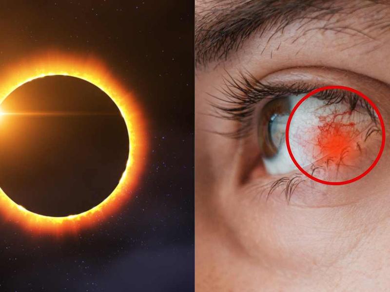 Hombre no sabe qué pasa si vio el eclipse sin protección.