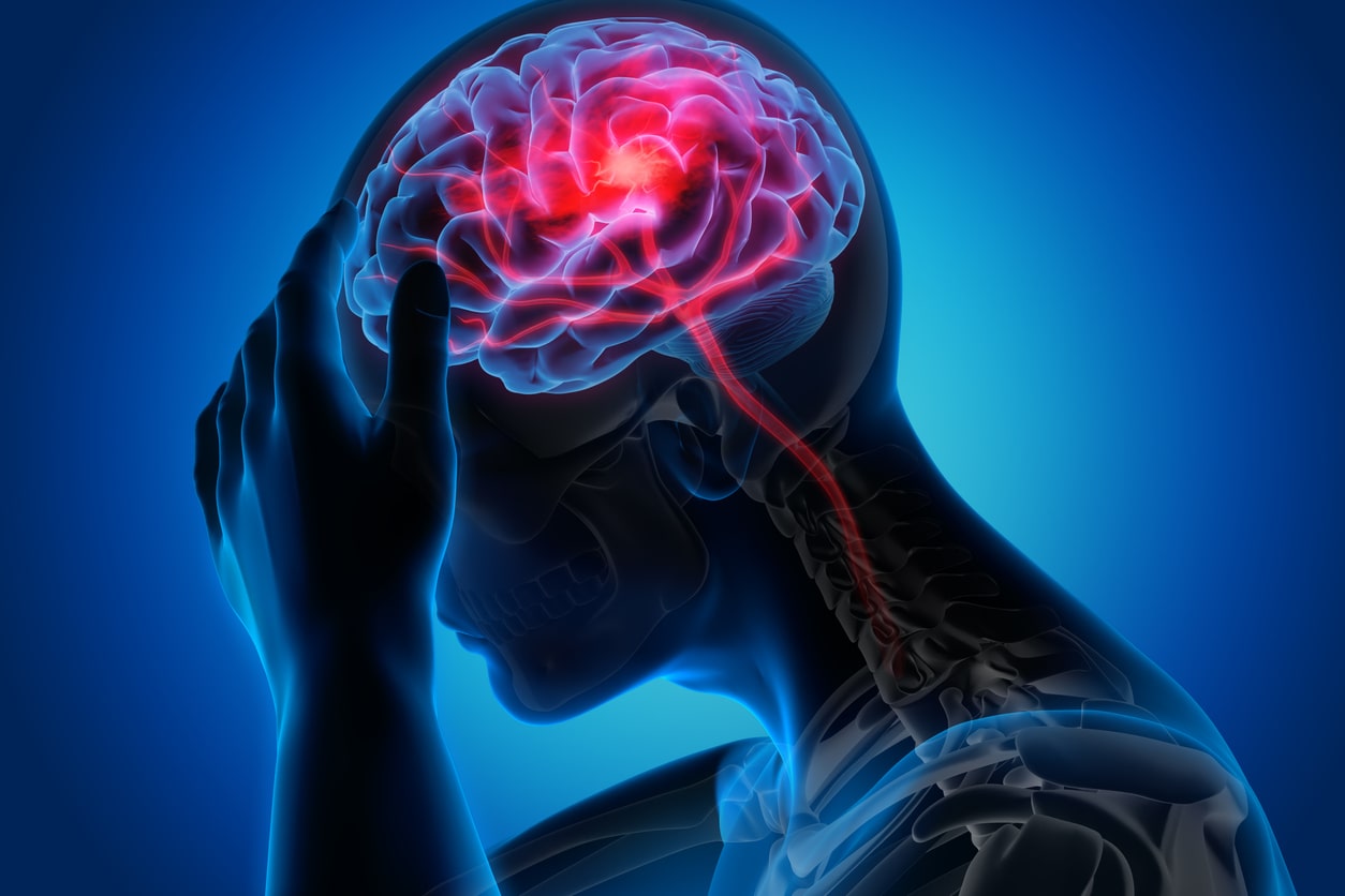 4 tipos de dolor de cabeza asociados al Covid-19