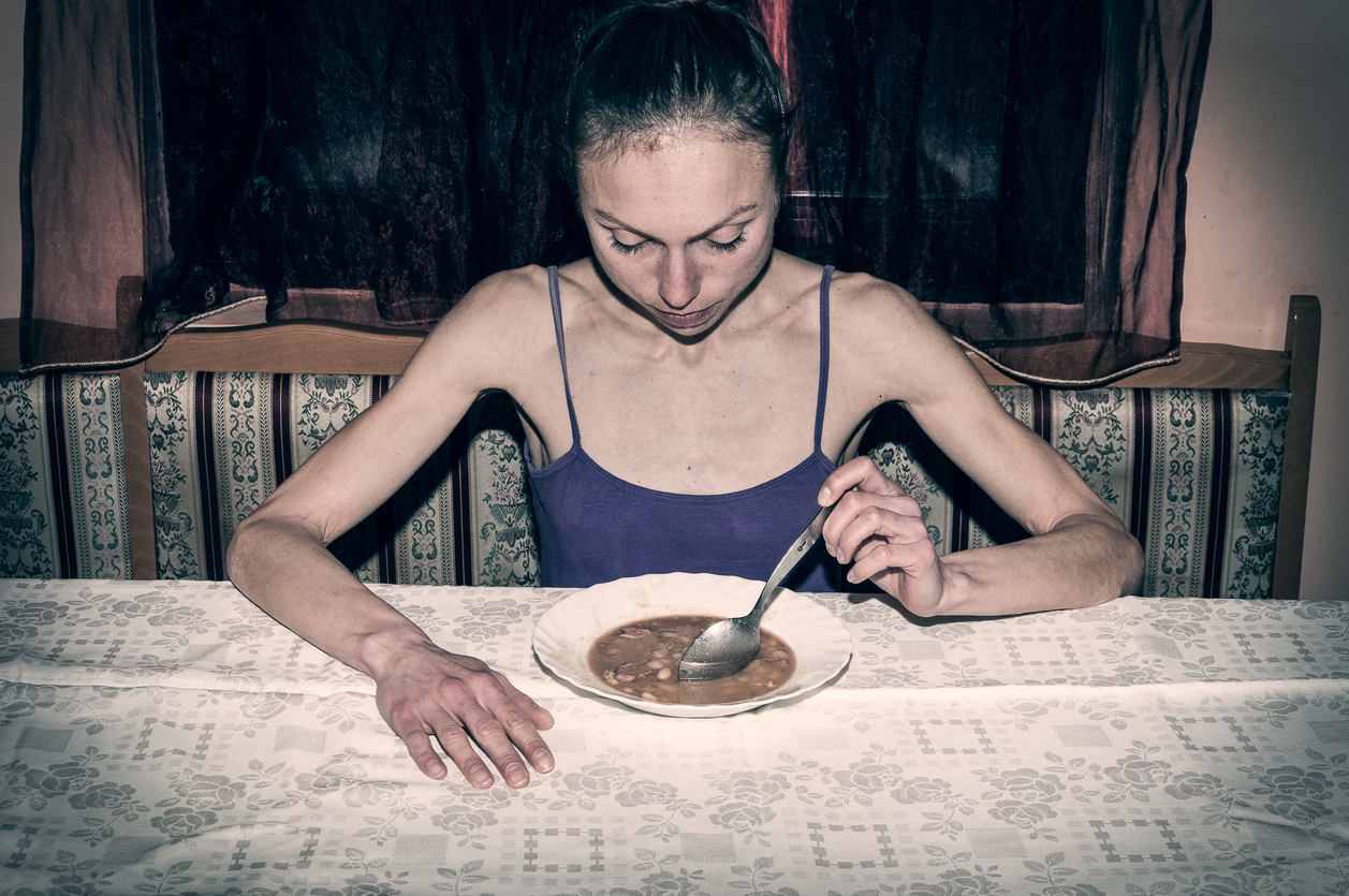 anorexia-salud180