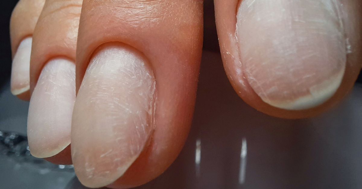 Cómo hacer crecer tus uñas en 1 mes (y eliminar la descamación): 4 trucos  que no sabías