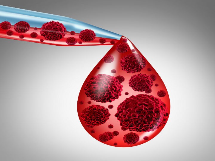 Cómo saber si tienes anemia