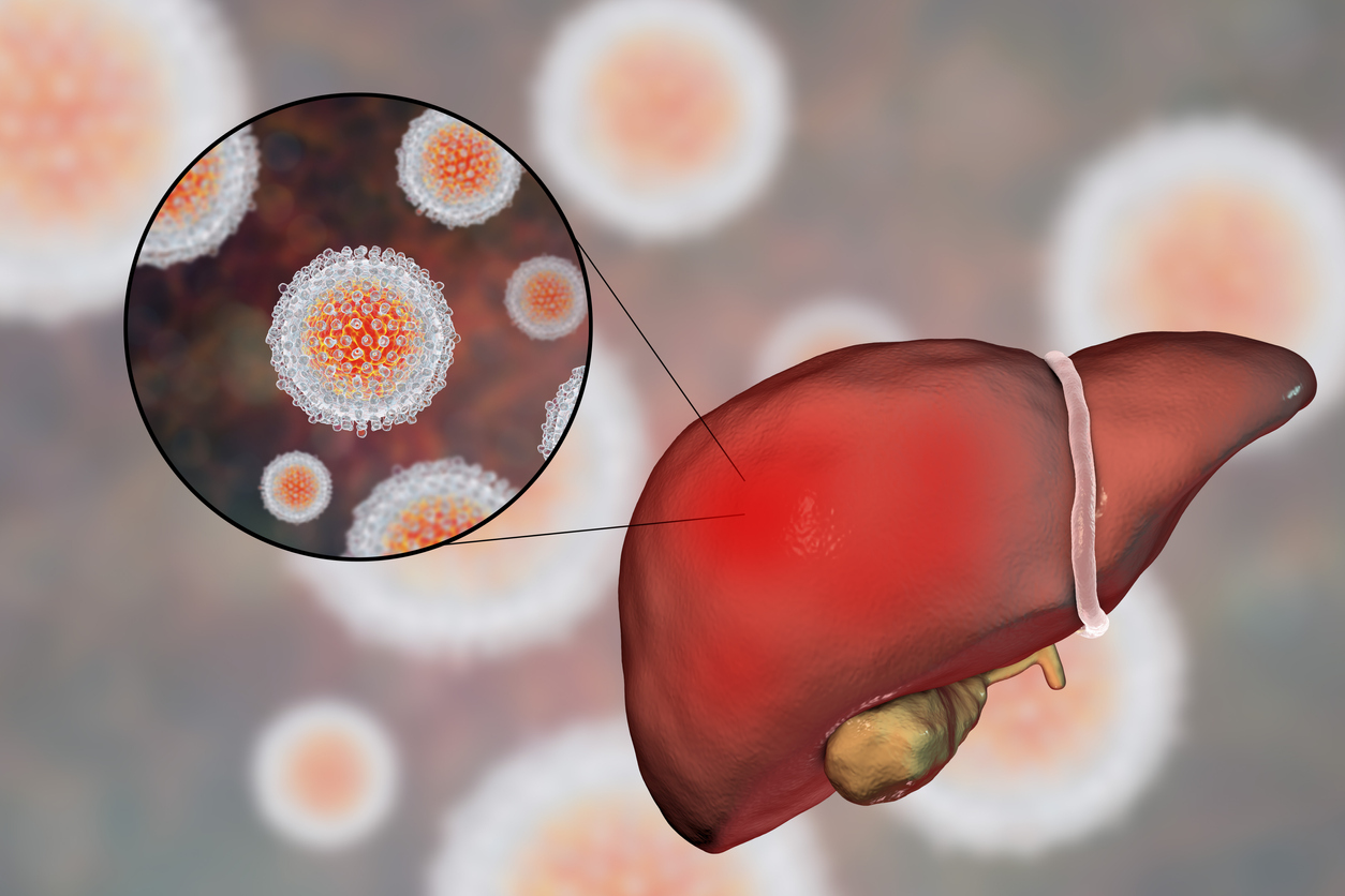 Virus de la hepatitis C daña al hígado