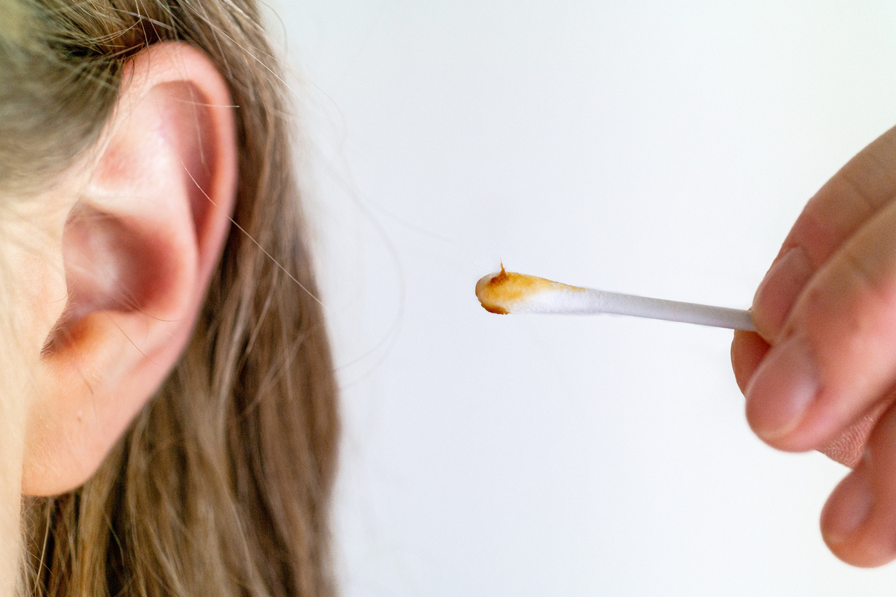 Cómo quitar los tapones de cera de los oídos - CIO Salud