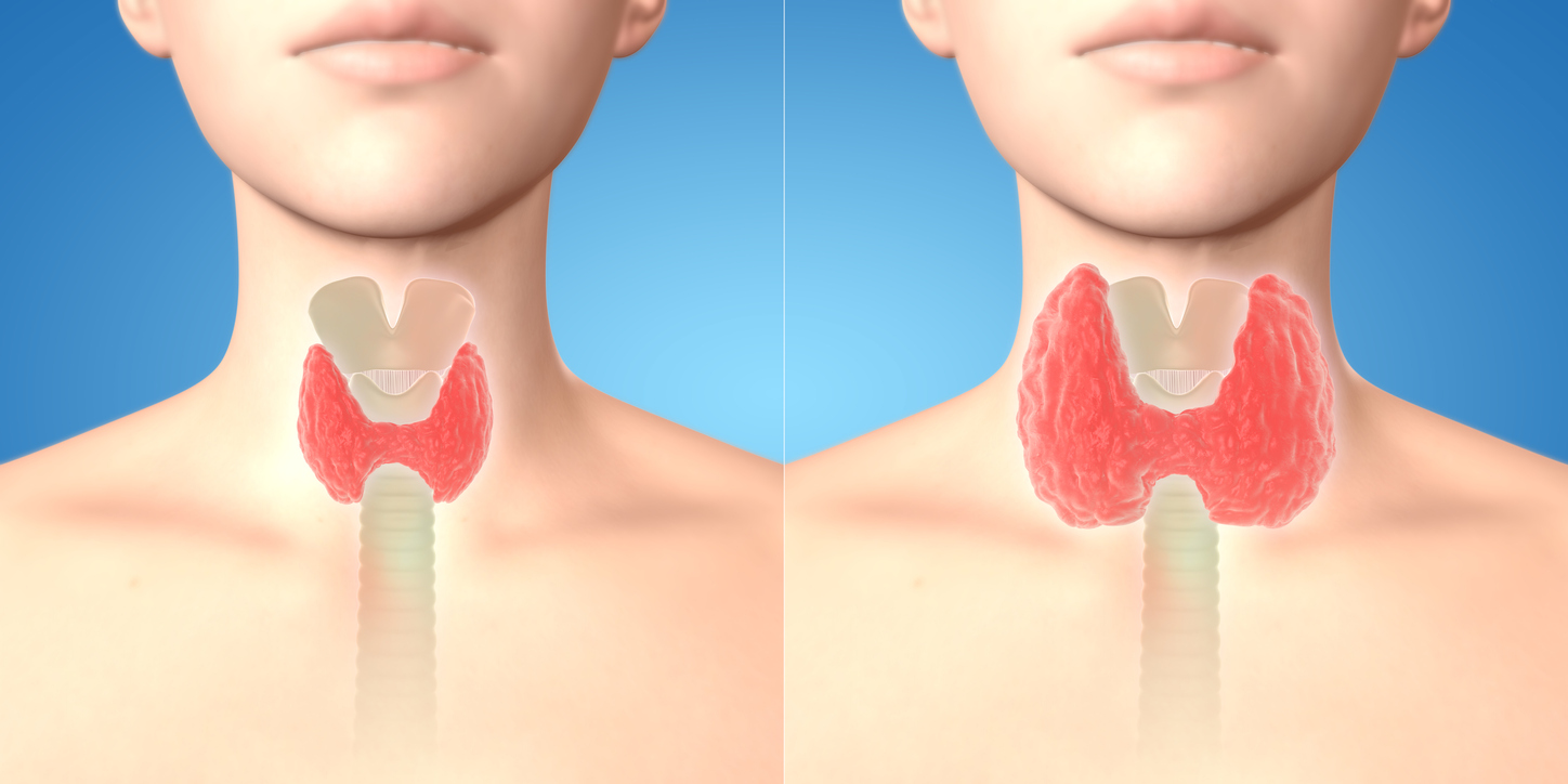 Tiroides: los cambios hormonales la pueden afectar