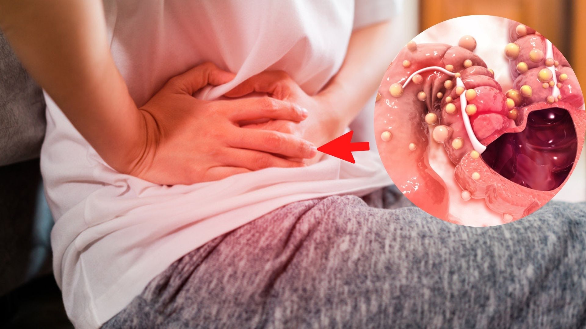 sintomas del cancer de colon hombres arată tot felul de viermi