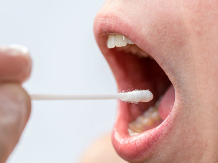 Papiloma virus en la boca, Hpv na lingua e garganta