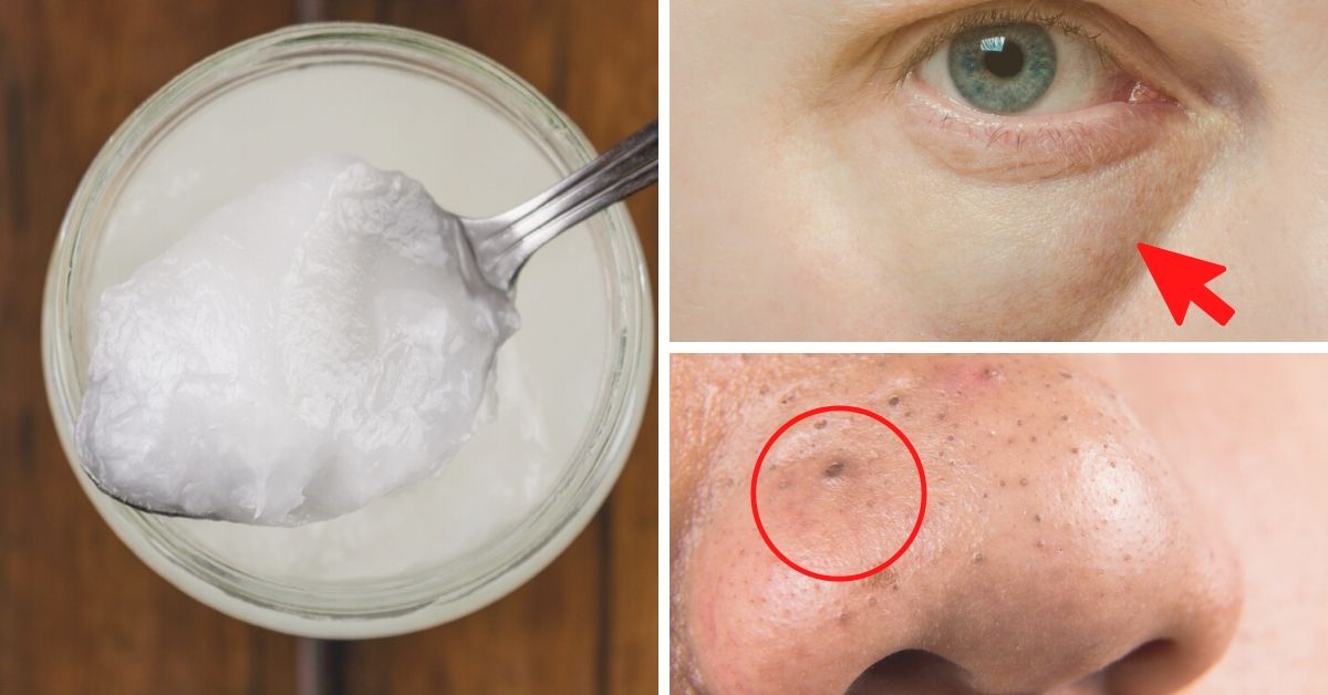 12 recetas con aceite coco para la cara que harán lucir y joven