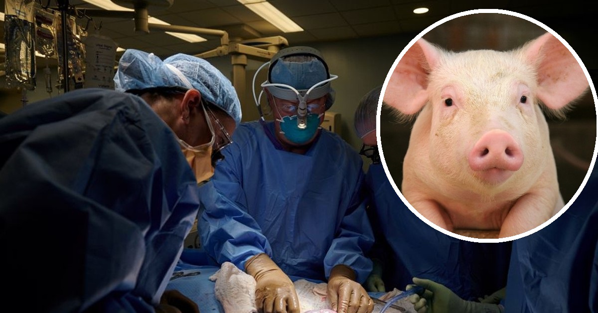 Realizan con éxito primer trasplante de riñón de cerdo en un paciente humano