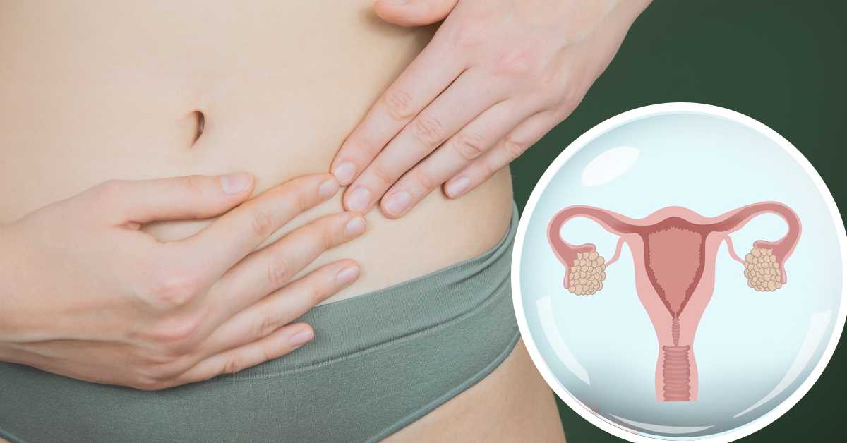 Dolor de ovarios ¿por ovulación? 8 causas de este dolor que no son tu ciclo menstrual