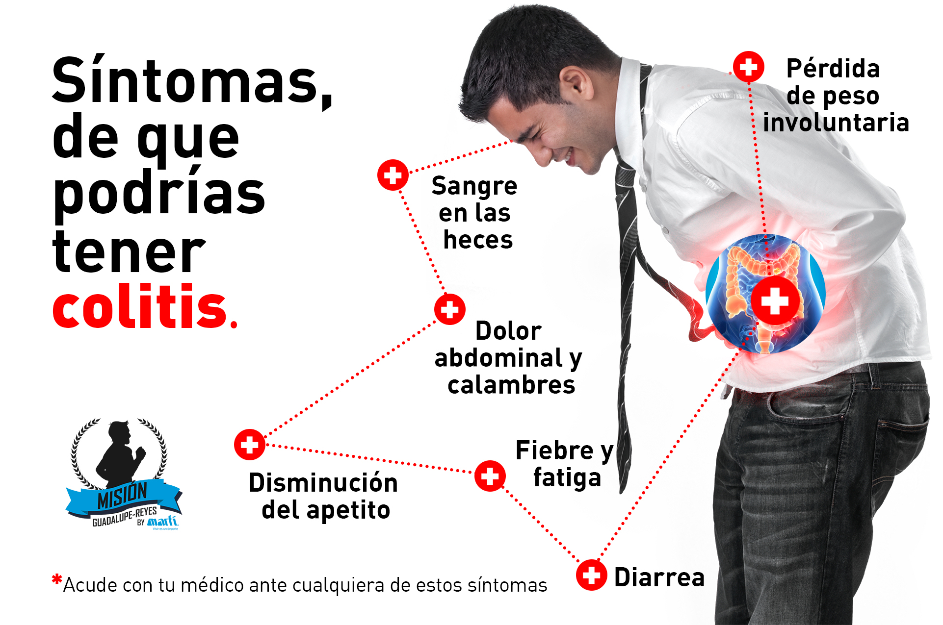 Colitis sintomas y causas
