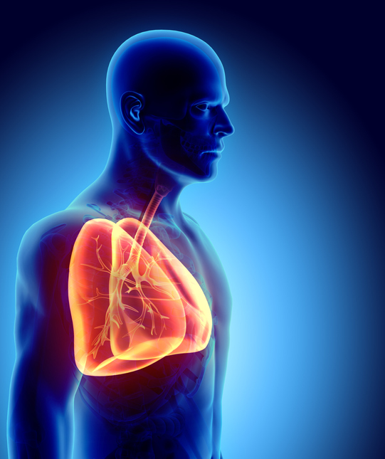 Factores de riesgo de cáncer de pulmón