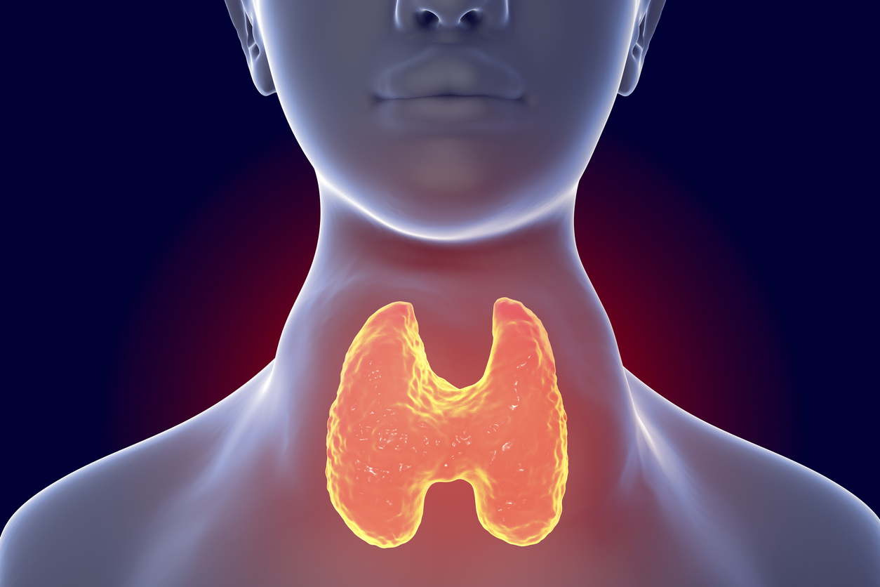 Nerviosismo, sudoración y 4 síntomas más que indican nódulos en la tiroides (bultos)