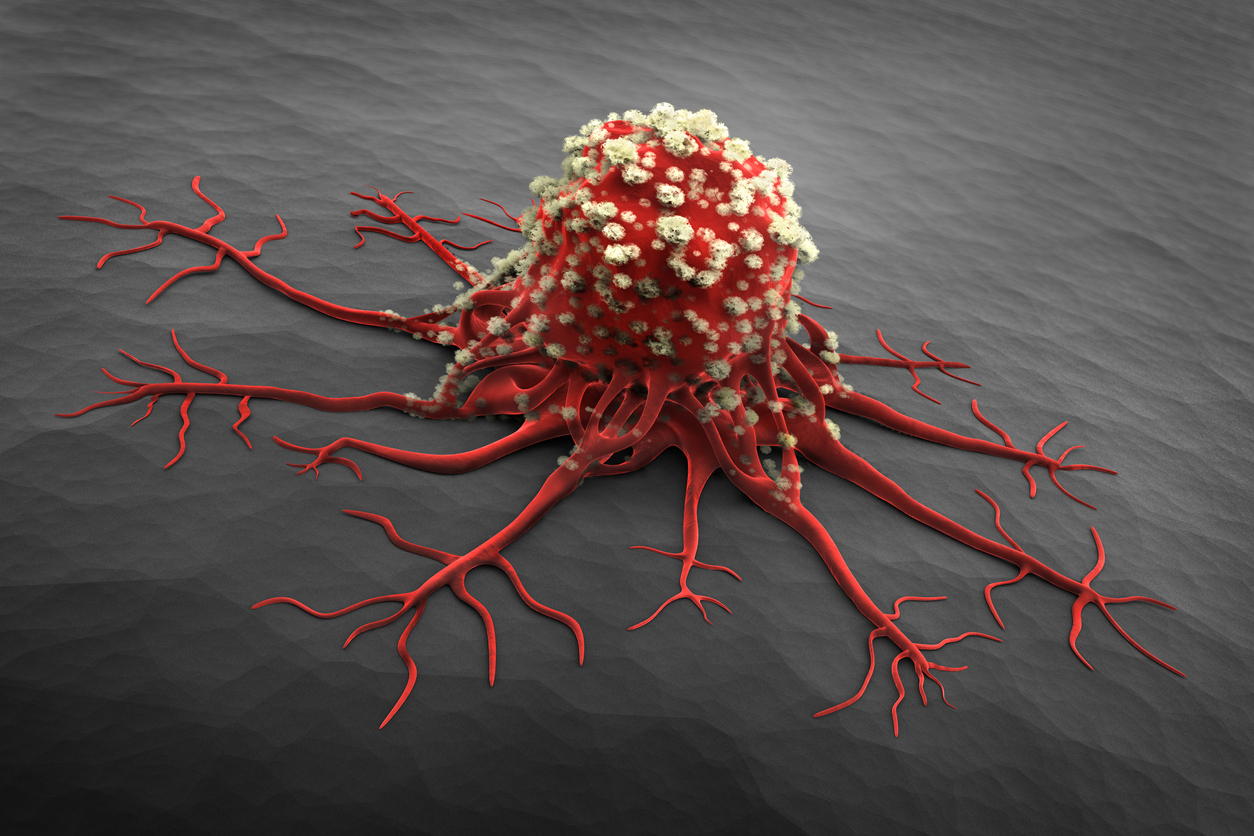Nuevo análisis de sangre detecta el cáncer con cuatro años de anticipación