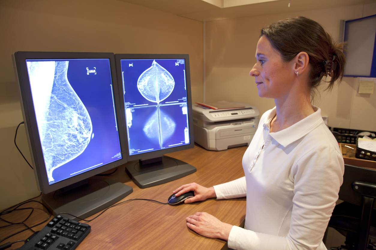 Los investigadores del MIT se basaron en la información de más de 90 mil mamografías que fueron realizadas a pacientes con cáncer de mama