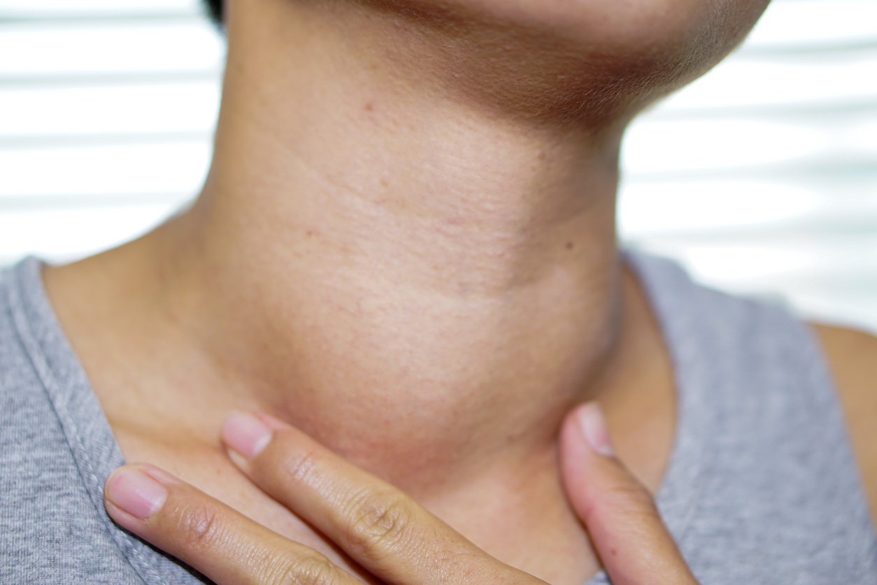 ¿Qué pasa si te quitan la tiroides? 4 casos en los que tu médico podría extirparla