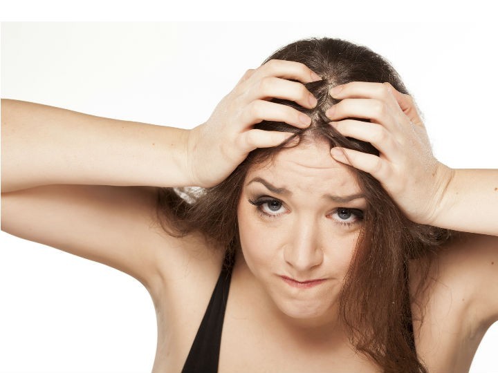La pérdida de cabello es uno de los temas que más preocupa a hombres y mujeres por igual, esto puede generar problemas de inseguridad 