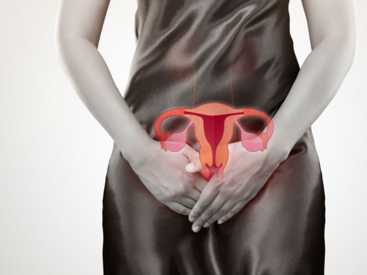 Dolor de espalda: señal inequívoca de cáncer de ovario