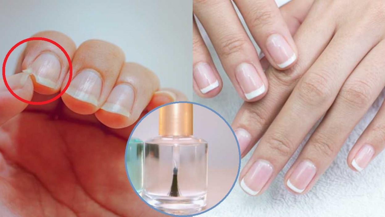 Cómo fortalecer las uñas con remedios caseros