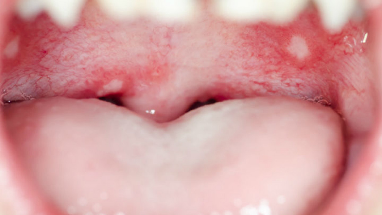 Circunferencia Eléctrico Escabullirse Despertar con la boca seca y amarga son síntomas de enfermedades graves