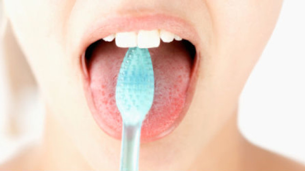 Cepillarse la lengua ayuda a remover la placa bacteriana.