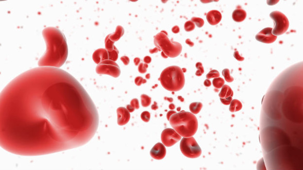 A nivel mundial, se estima que existan al menos 400 mil personas con hemofilia