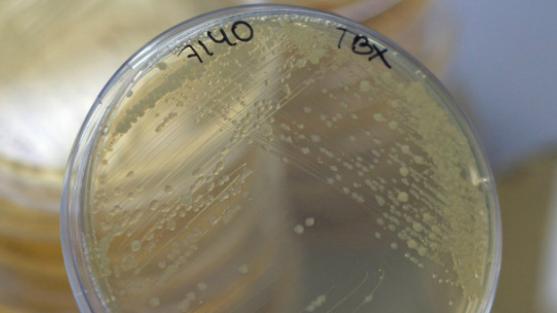 E. coli se transmite de persona a persona