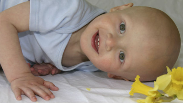 El 80% de los niños padecen leucemia infoblástica del tipo B