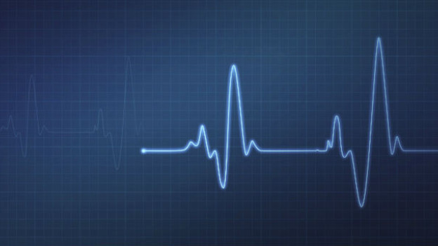 electrocardiograma.jpg