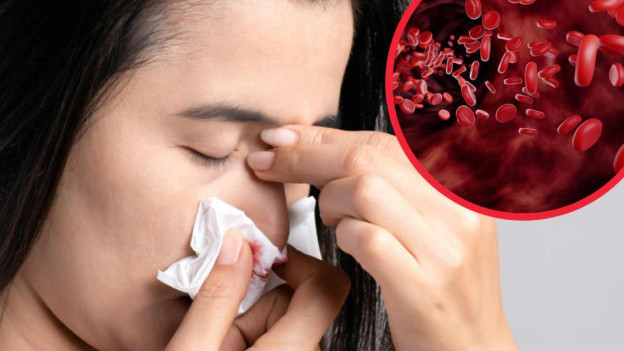 Mujer le sangra la nariz cuando hace frío. 