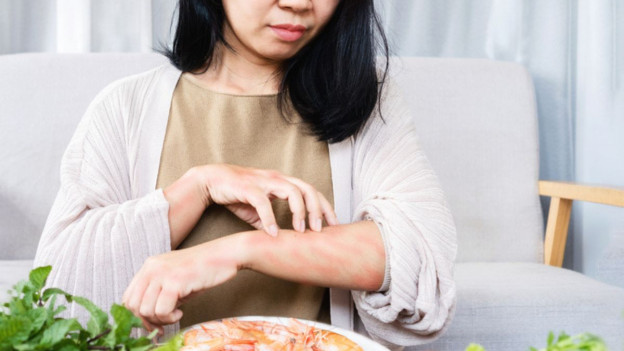 Mujer rascándose el brazo con plato de camarones en frente para explicar cuáles son las alergias más comunes
