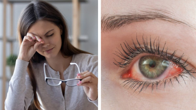 Mujer frotándose el ojo, mujer con ojo rojo muestra cómo aliviar el ojo seco